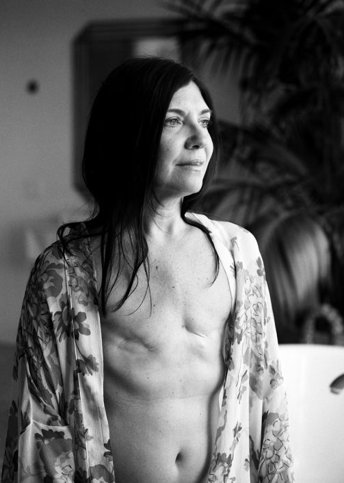 a black and white image of a woman wearing an open shirt and showing the scars of her surgery